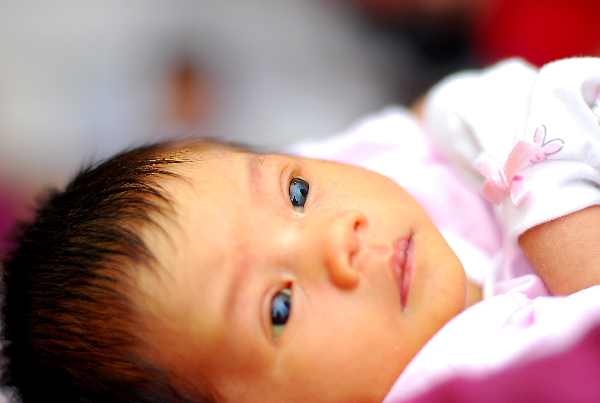 Newborn Jaundice
